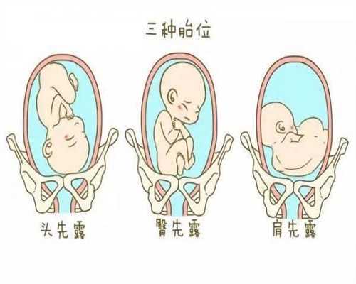 北京代孕包成功_私人代孕网_代怀孕在线咨询