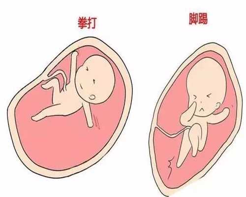 北京代孕网_靠谱的供卵代怀孕_唐雪代孕