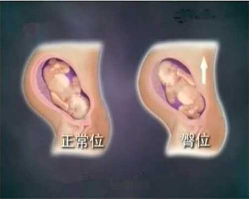 北京代孕免费咨询_代孕儿子咨询_代孕一个儿子多少钱